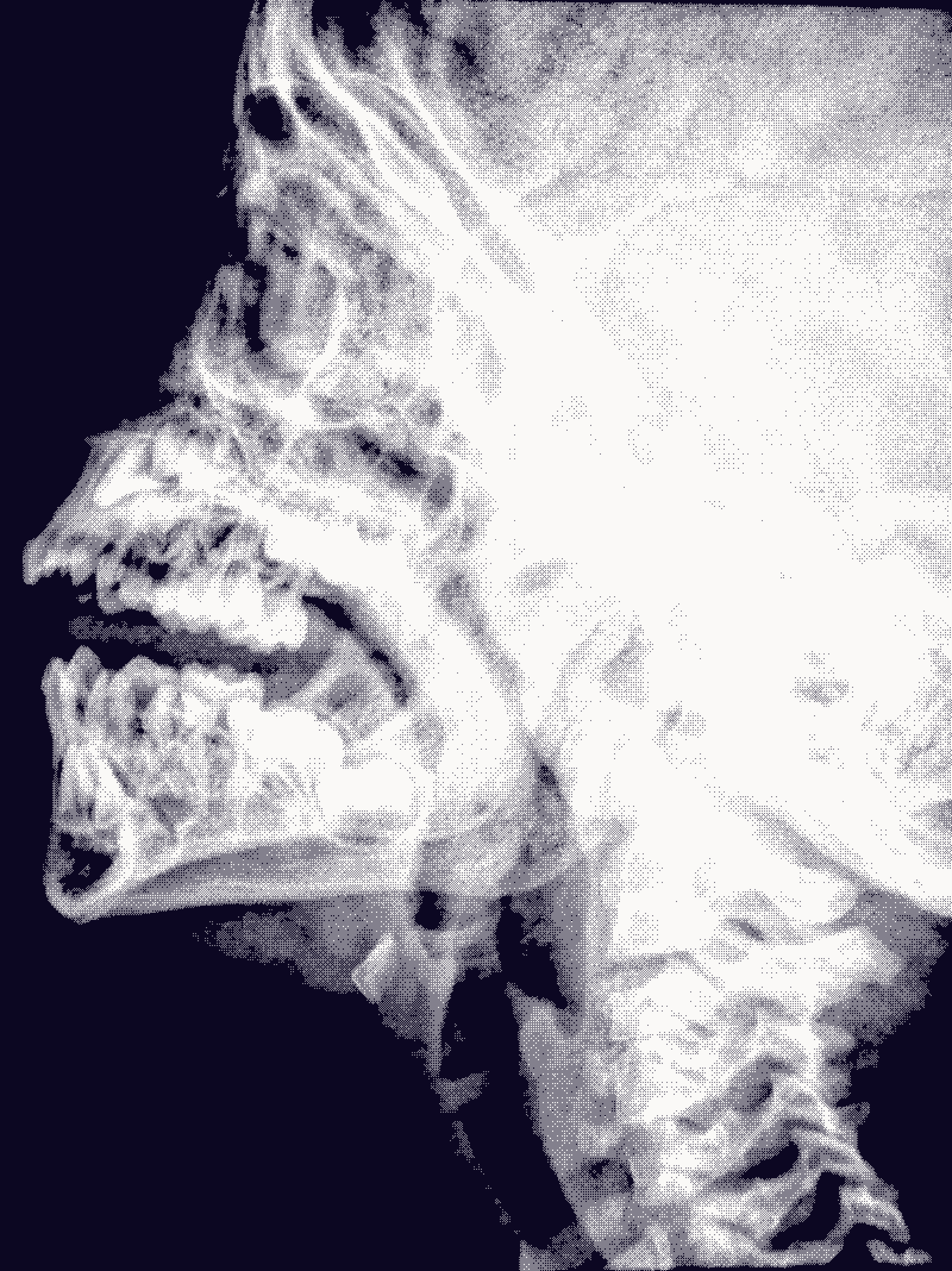 A lateral skull radiograph, jaw and teeth resolving out of grey film grain
